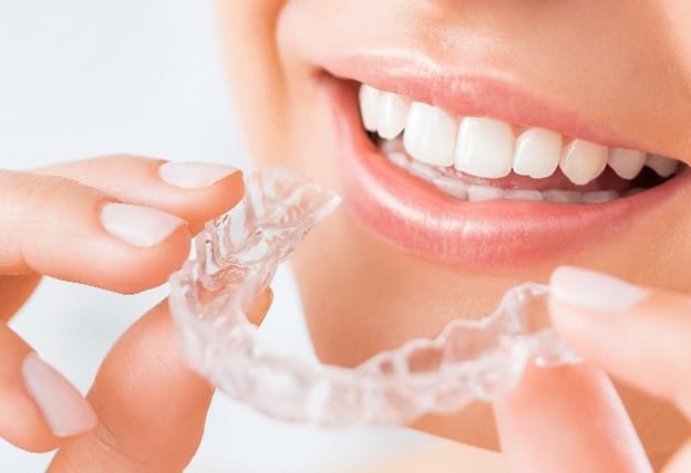 En person som sätter in en osynlig tandställning (aligner) för tandreglering.